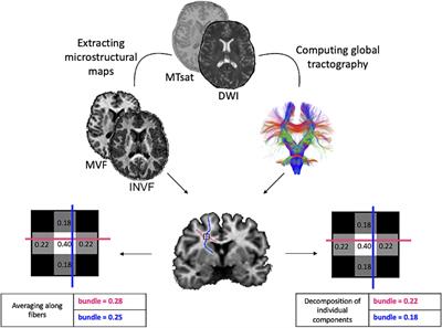 Evaluation of tractography-based myelin-weighted connectivity across the lifespan